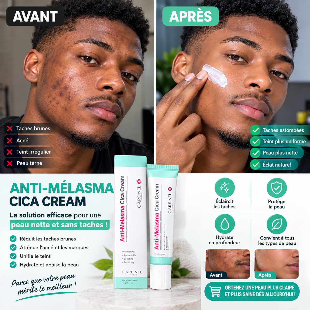 Cream Anti-Melasma — Dites adieu aux taches, bonjour à l'éclat