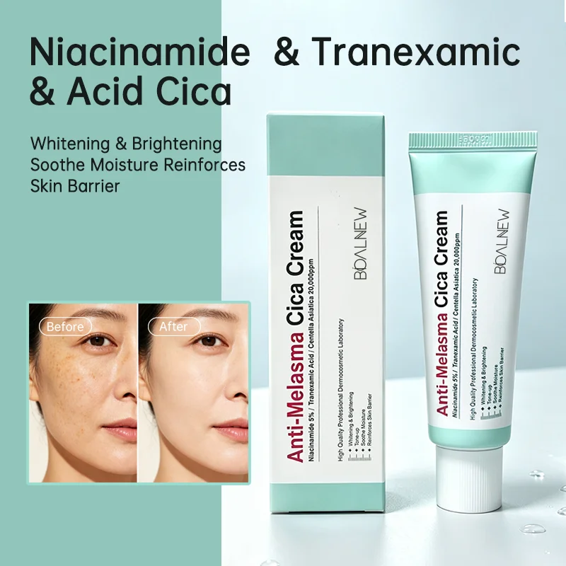 Cream Anti-Melasma — Dites adieu aux taches, bonjour à l'éclat